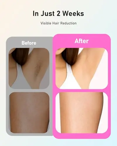 Depilación Láser LYSMOSKI: IPL para Hombres y Mujeres, Resultados Visibles en 2 Semanas, Tratamiento Completo en 8 Minutos - imagen 3